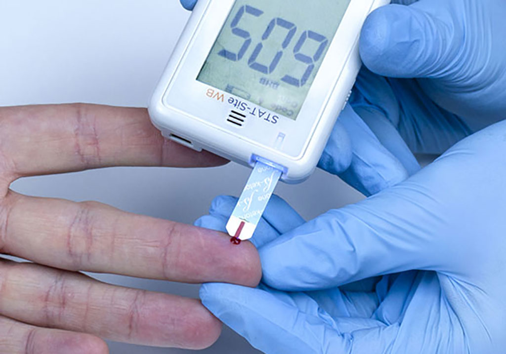 Image: STAT-Site WB β-Ketone and Glucose Handheld Analyzer (Photo courtesy of EKF Diagnostics)