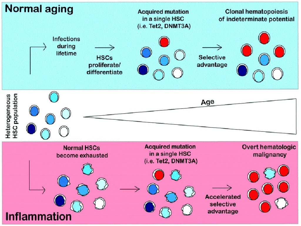 Image: Model of clonal hematopoiesis in normal and inflammatory conditions. In a normal person, hematopoietic stem cells (HSCs) will differentiate and self-renew over the course of a lifetime to replenish the blood system. HSCs will acquire somatic mutations as a result of proliferative stress (Photo courtesy of University of California Irvine).