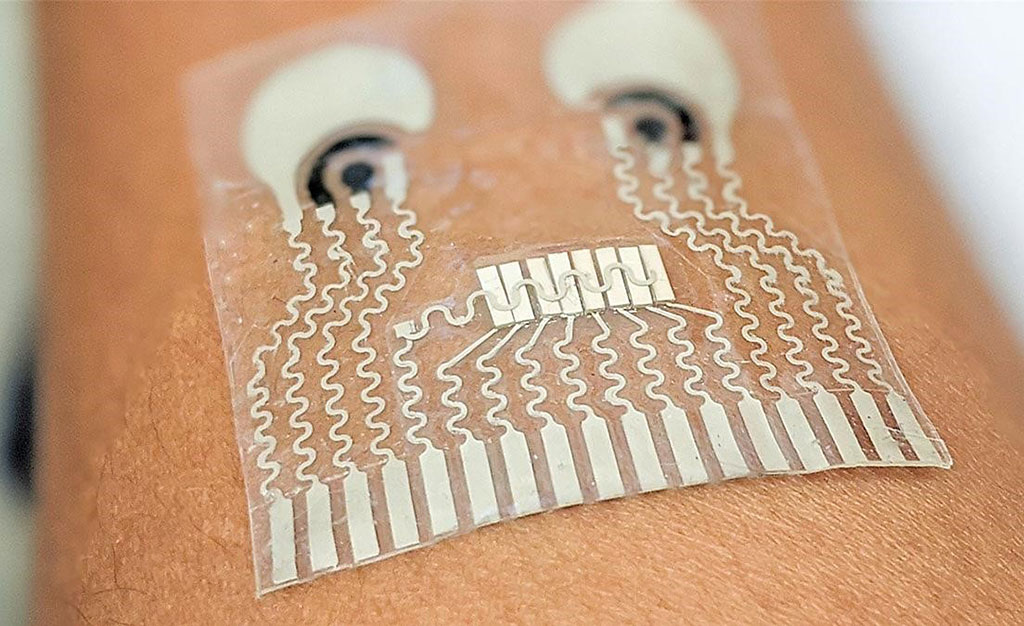 Image: The first wearable device for simultaneous monitoring of hemodynamic and biochemical biomarkers (Photo courtesy of University of California, San Diego)