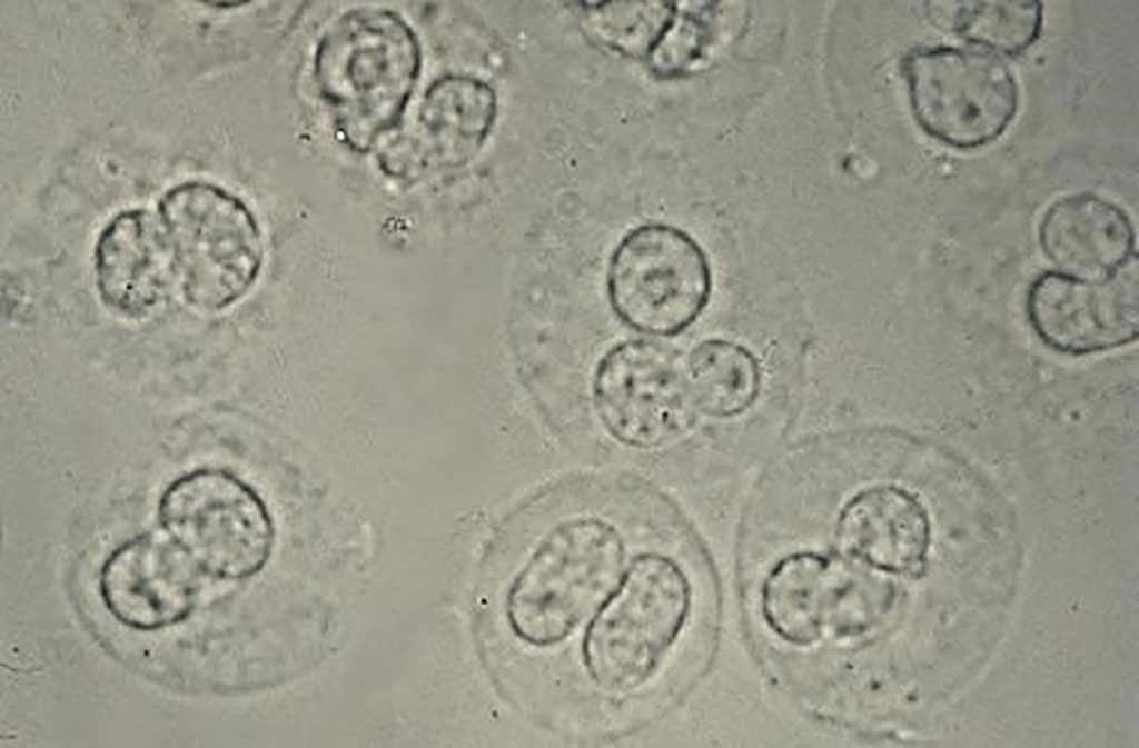 Wbc In Urine 5959