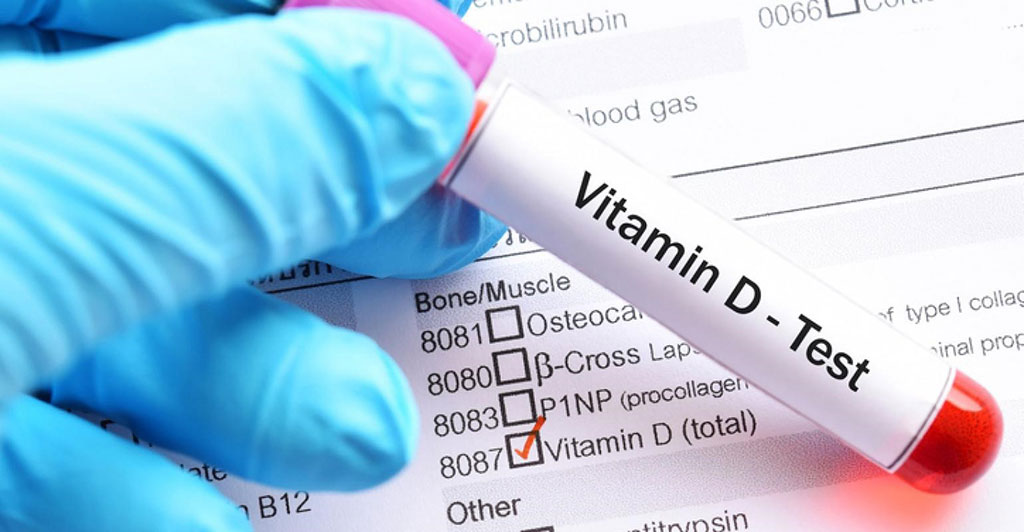 Image: A blood test for Vitamin D showed that African-Americans individuals with low Vitamin D were more at risk from COVID-19 (Photo courtesy of Getty Images)