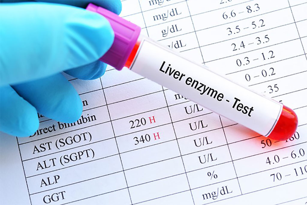 Image: Elevated liver enzymes are associated with incident diabetes in US Hispanic/Latino adults (Photo courtesy of Judy George, BA, MBA)