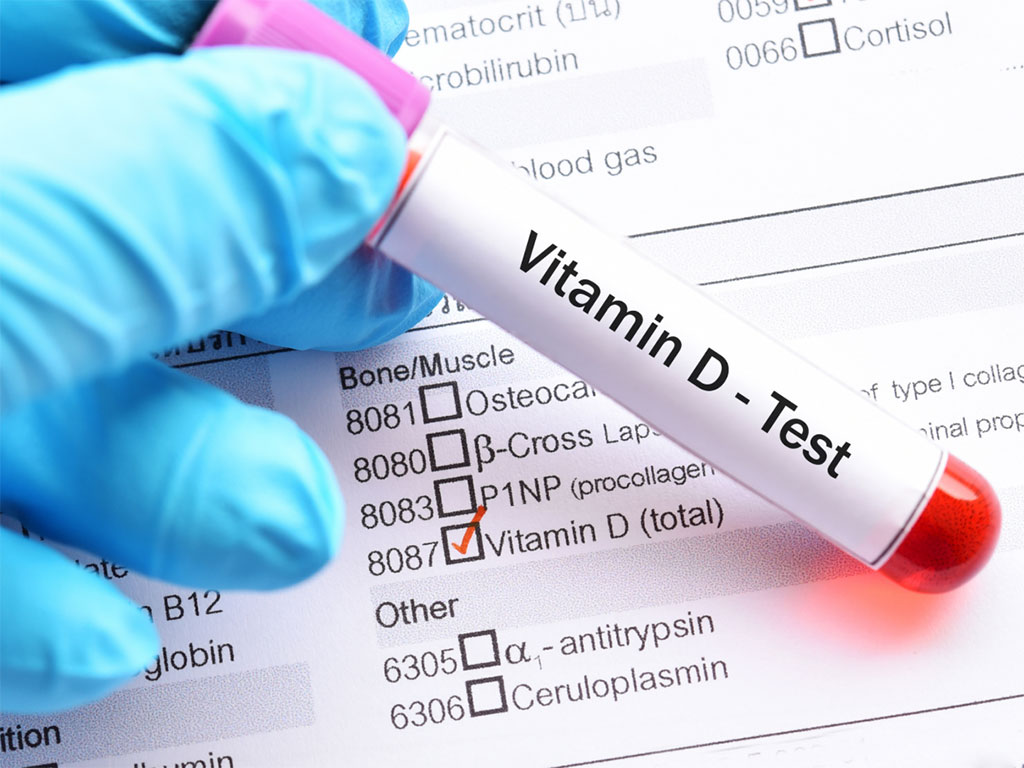 Image: Lower vitamin D levels are associated with metabolic syndrome and insulin resistance in systemic lupus (Photo courtesy of Nikki Yelton, RD)