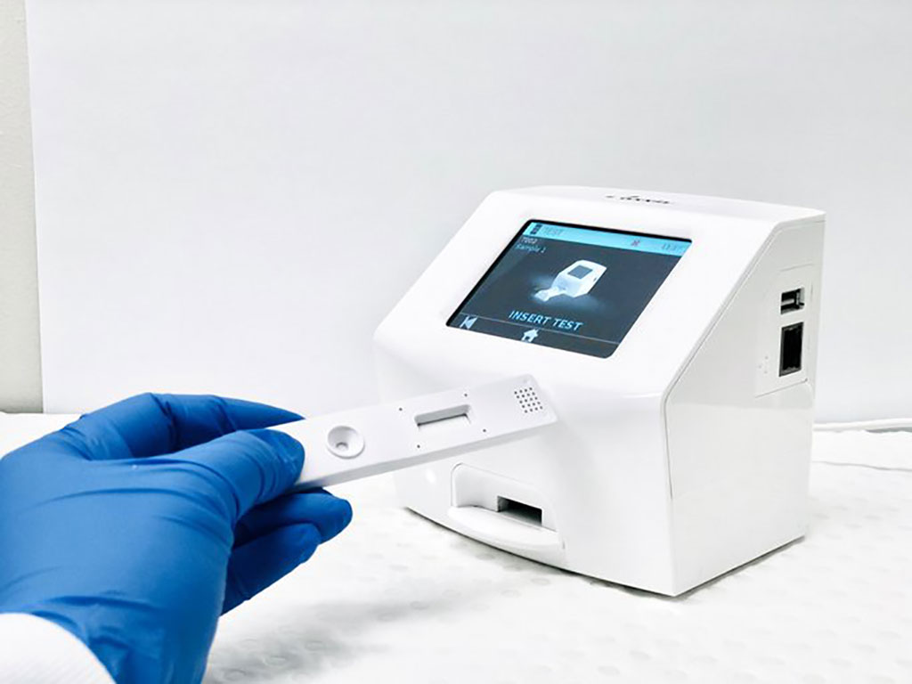 Image: AnteoTech’s EuGeni Reader and in vitro rapid diagnostic test (Photo courtesy of AnteoTech Ltd.)