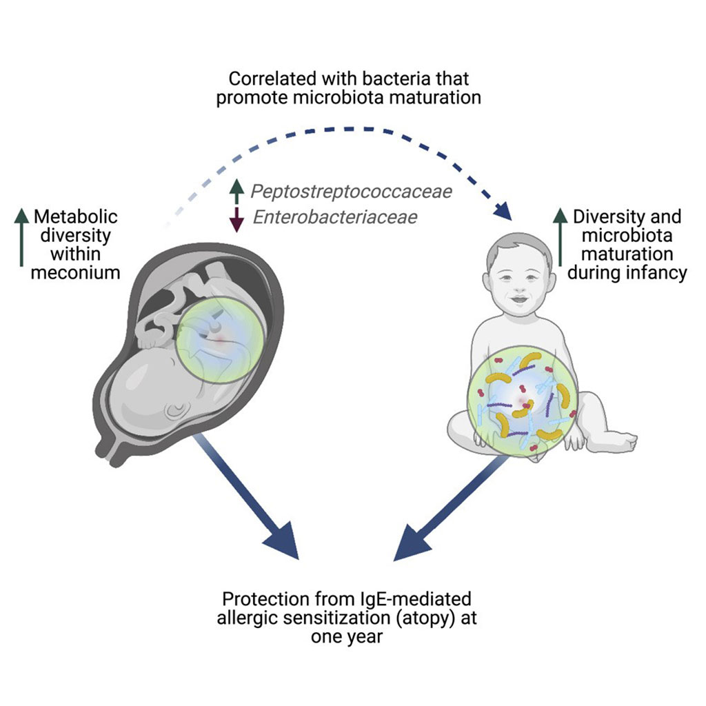 Image: Schematic diagram of a rich meconium metabolome in human infants is associated with early-life gut microbiota composition and reduced allergic sensitization (Photo courtesy of University of British Columbia)