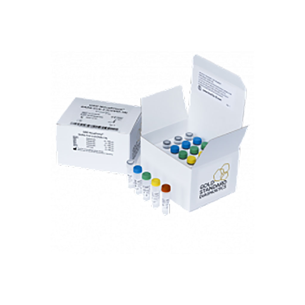 Image: GSD NovaType III SARS-CoV-2 RT-PCR assay (Photo courtesy of Eurofins Technologies)