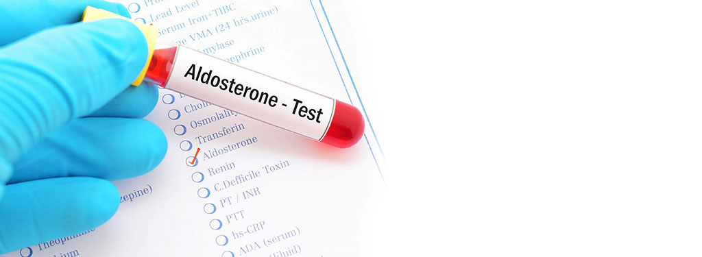 Image: Blood test for  plasma aldosterone concentration was used to screen For hyperaldosteronism in hypertensive men (Photo courtesy of  VisitHealth Ltd)