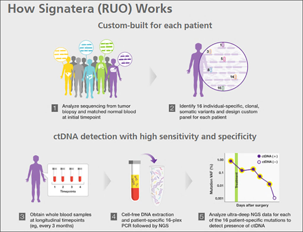 Image: Schematics of how the Signatera bespoke mPCR NGS assay works (Photo courtesy of Natera)