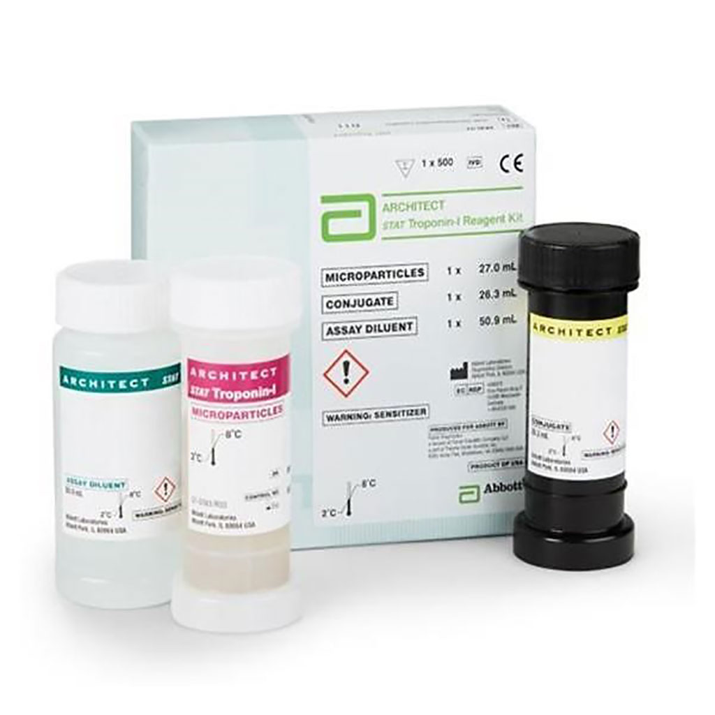 Image: ARCHITECT STAT High Sensitivity Troponin-I blood test (Photo courtesy of Abbott Laboratories)