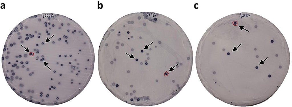 Image: Immunoscreening of TIA antigens by SEREX. Bacterial proteins including phage cDNA products were blotted on nitrocellulose membranes and reacted with the sera of patients with transient ischemic attack (TIA); arrows indicate positive phage clones (Photo courtesy of Chiba University)