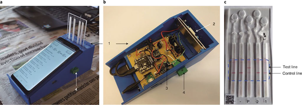 Image: Smartphone-based DNA diagnostics for malaria detection using deep learning for local decision support and blockchain technology for security (Photo courtesy of University of Glasgow)