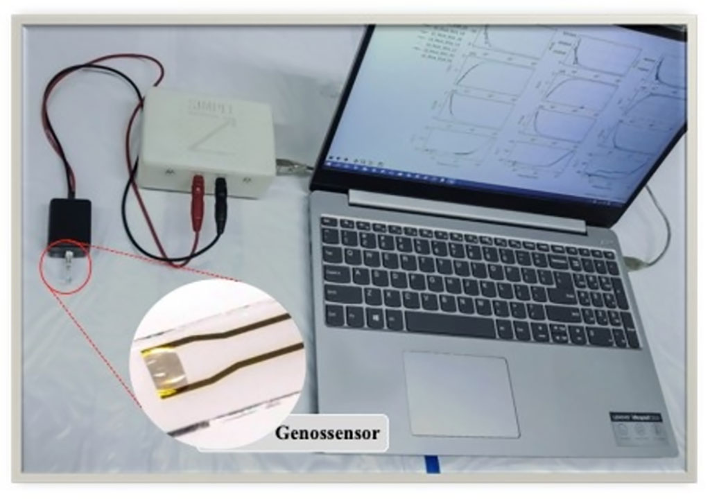 Image: Impedance analyzer connected to DNA biosensor that can be used to detect genetic sequence from SARS-CoV-2 (Photo courtesy of Lorenzo A. Buscaglia/IFSC-USP)