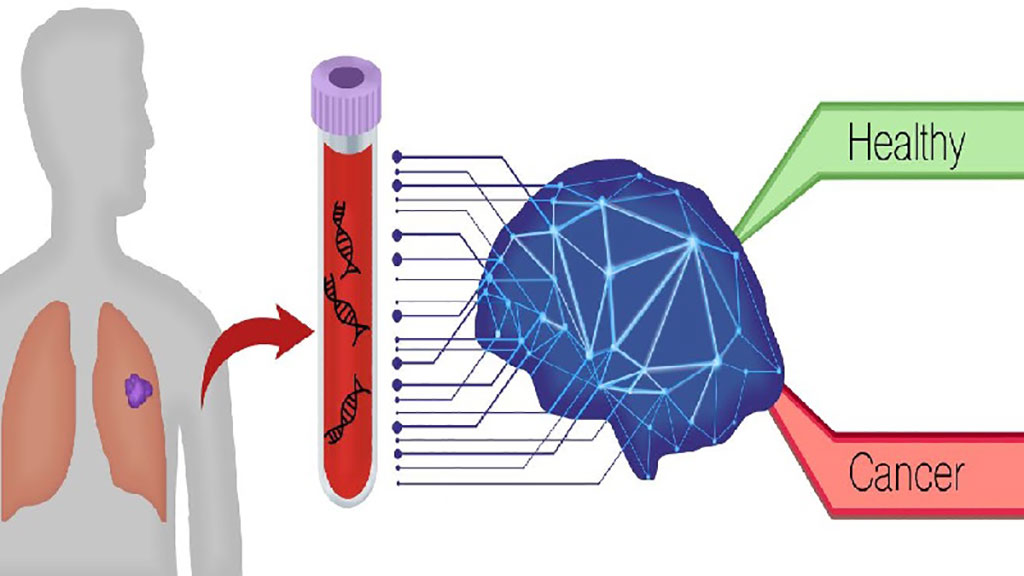 Image: DELFI blood test identifies lung cancer using artificial intelligence to detect unique patterns in the fragmentation of DNA shed from cancer cells compared to normal profiles (Photo courtesy of Carolyn Hruban)