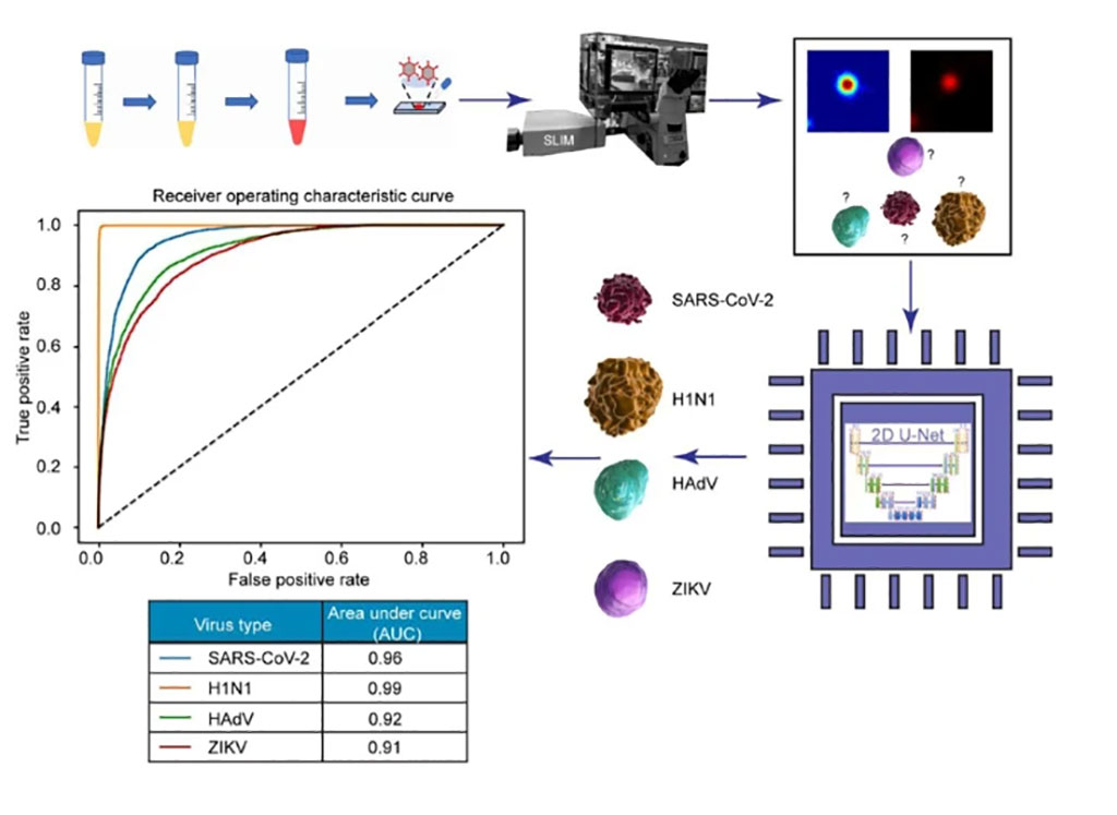 Image: The AI discerned between four particles: SARS-CoV-2, H1N1, HAdV, and ZIKV. The preclinical trial resulted in a 96% success rate for SARS-CoV-2 detection and classification (Photo courtesy of Beckman Institute for Advanced Science and Technology)