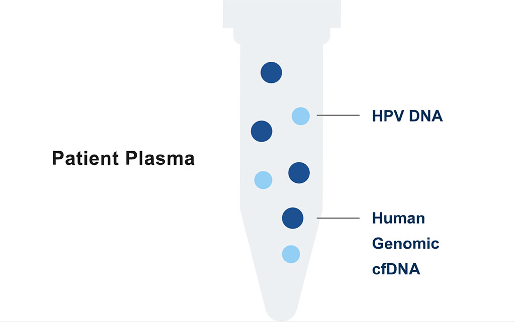 Image: The HPV-Seq test is an ultra-sensitive liquid biopsy solution for the identification and quantification of circulating HPV 16 and HPV 18 DNA in patients with cancers caused by HPV infection (Photo courtesy of Sysmex Inostics)