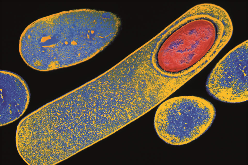 Image: Colored Transmission electron micrograph of Clostridium difficile bacterium forming an endospore (lower right, red oval). Clostridium difficile produce a toxin that irritates the colon and causes diarrhea (Photo courtesy of Kari Lounatmaa, PhD)