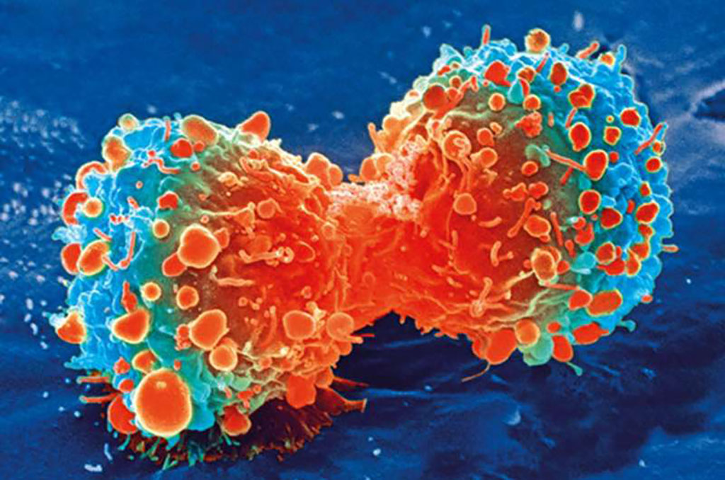 Image: A cancer cell during cell division (Photo courtesy of [U.S.] National Institutes of Health)