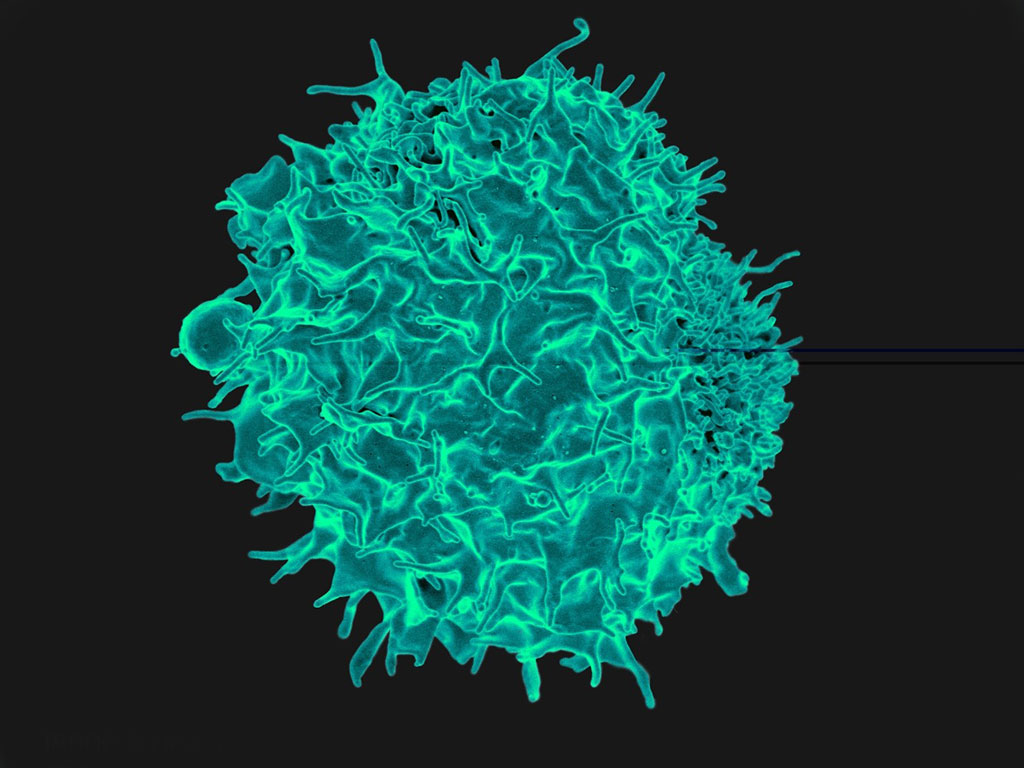 Image: Scanning electron micrograph of a CD4+ T cell – these cells expresses elevated levels of S100B in PE/HELLP patients (Photo courtesy the British Society of Immunology)