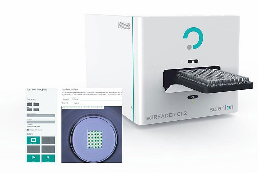 Image: The sciREADER CL2 enables high quality digital colorimetric imaging of various support formats (Photo courtesy of SCIENION)