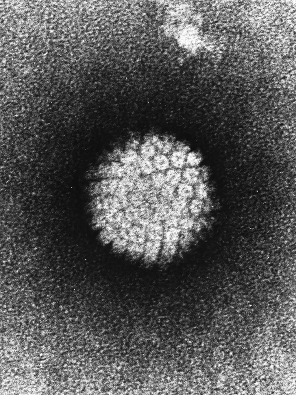 Image: Electron micrograph of human papilloma virus (HPV) (Photo courtesy of [U.S.] National Institutes of Health via Wikimedia Commons)