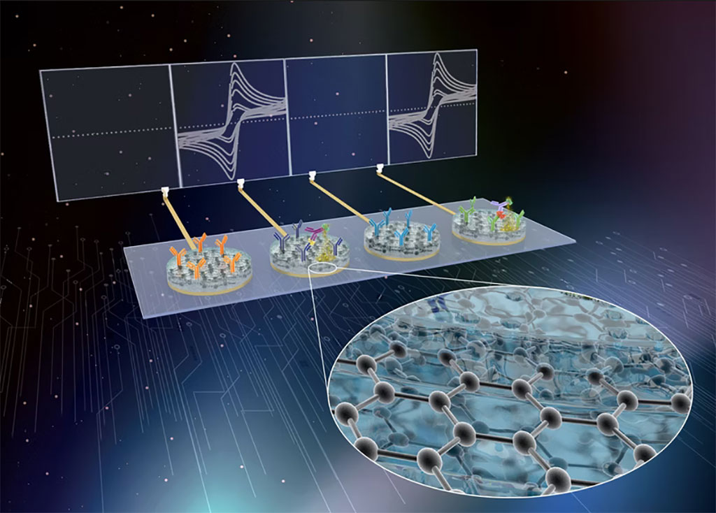 Image: The Wyss Institute’s eRapid electrochemical sensor technology (Photo courtesy of Harvard Wyss Institute)