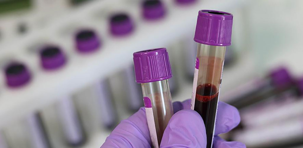 Image: Personalized blood test for cancer patients (Photo courtesy of University of Cambridge)