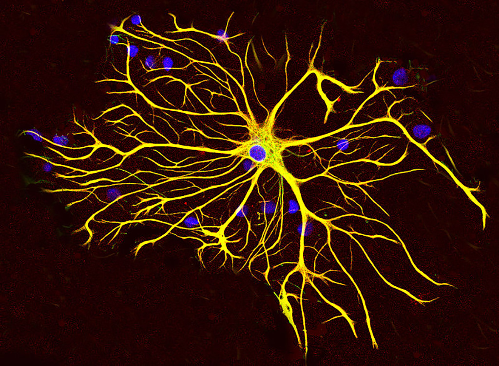 Image: An astrocyte cell grown in tissue culture stained with antibodies to GFAP and vimentin (Photo courtesy of Wikimedia Commons)