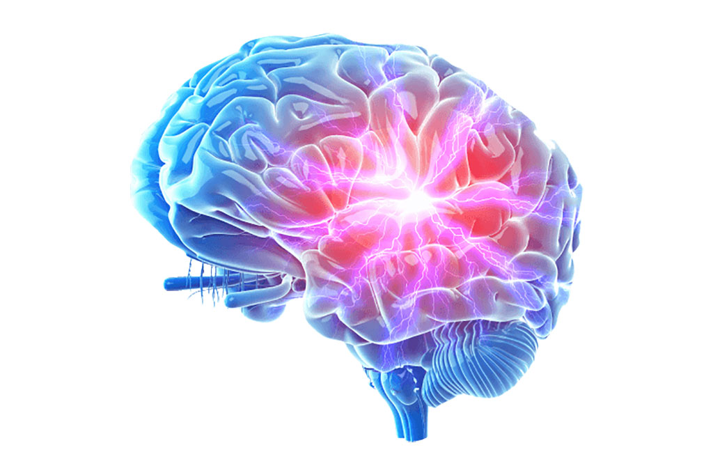 Image: Blood-based assay could aid management of relapsing-remitting form of MS (Photo courtesy of Quanterix)