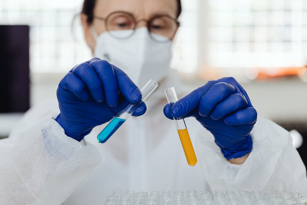 Image: Urine test for bladder cancer could replace 1000s of invasive cystoscopies each year (Photo courtesy of Pexels)