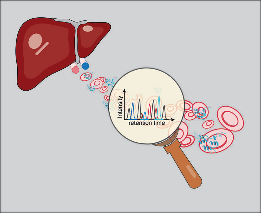 Image: By using mass spectrometry-based proteomics, investigators were able to measure the intensity of important proteins (biomarkers, peaks in the graph) and therefore diagnose alcohol-related liver disease at an early stage (Photo courtesy of Lili Niu © Novo Nordisk Foundation, Center for Protein Research)