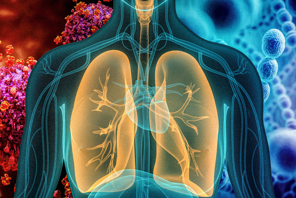 Image: Nanoparticle sensor can distinguish between viral and bacterial pneumonia (Photo courtesy of MIT)