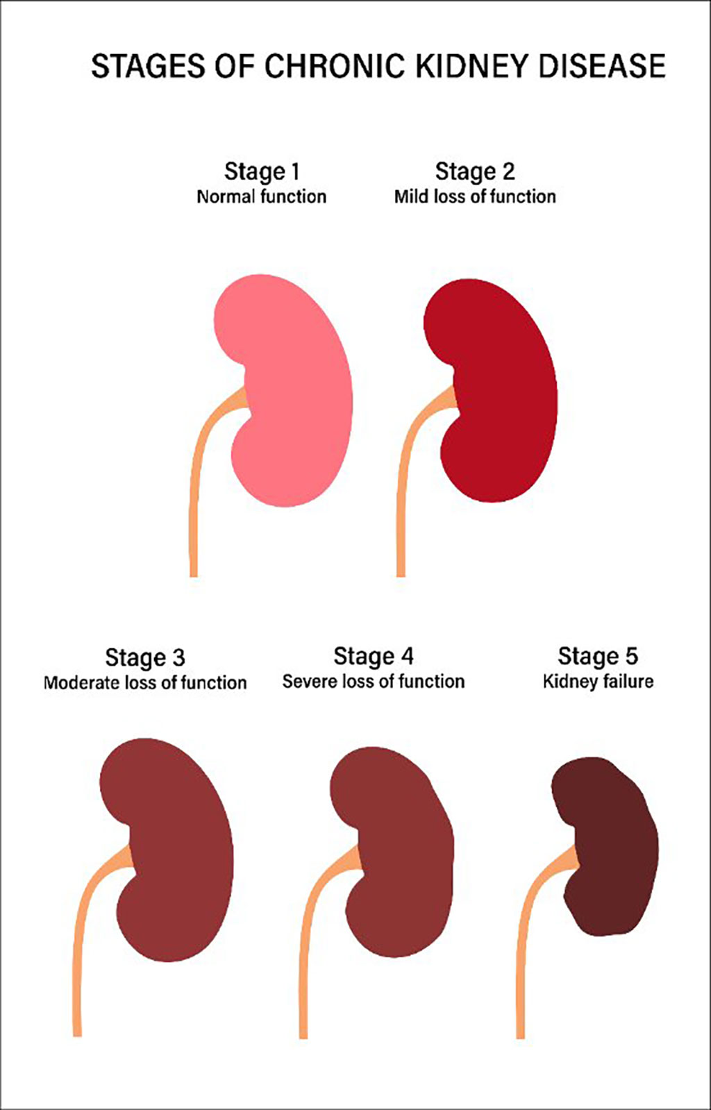 Image: Visual representation of the kidney disease concept (Photo courtesy of 123rf.com)