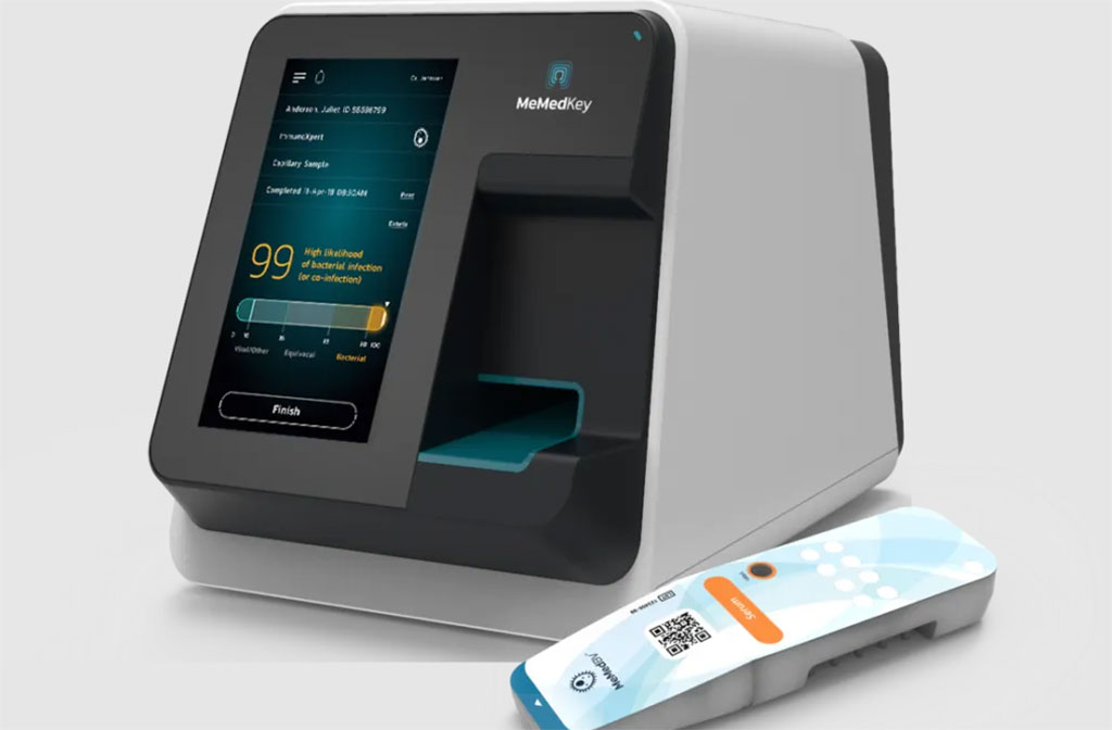 Image: MeMed Key is a multi-purpose immunoassay platform for quantitative diagnostic immunoassays that opens the way to central laboratory performance at the point-of-need, using chemiluminescence detection technology (Photo courtesy of MeMed)