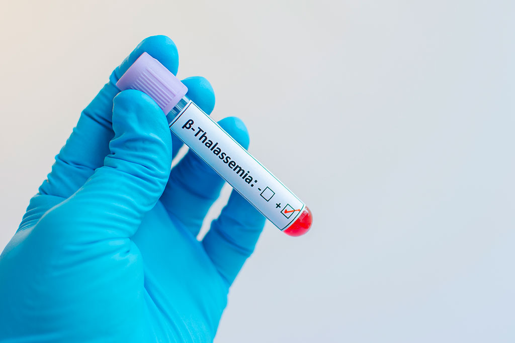 Image: Preventing and treating thalassemia with genomics (Photo courtesy of BGI Genomics)