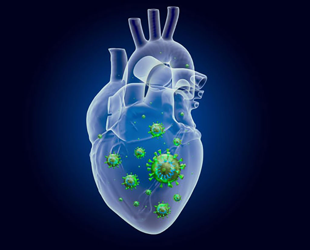 Image: IL-1RA antibody levels measured as a biomarker in young males with myocarditis after SARS-CoV-2 vaccination (Photo courtesy of Patrice Wendling)