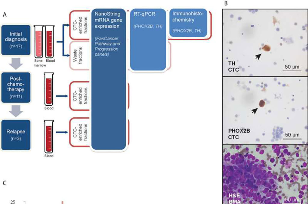 Image: Neuroblastoma circulating tumor cells (CTCs) expressing characteristic genetic biomarkers were isolated using cell size-based separation (Photo courtesy of Frontiers in Oncology (2022). DOI: 10.3389/fonc.2022.939460)