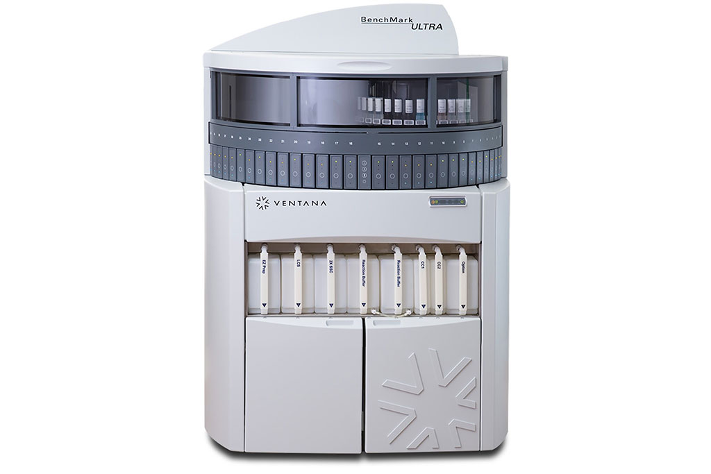 Image: The BenchMark ULTRA system is Roche Tissue Diagnostics’ most innovative, fully-automated immunohistochemistry and in situ hybridization slide staining system (Photo courtesy of Roche Group)