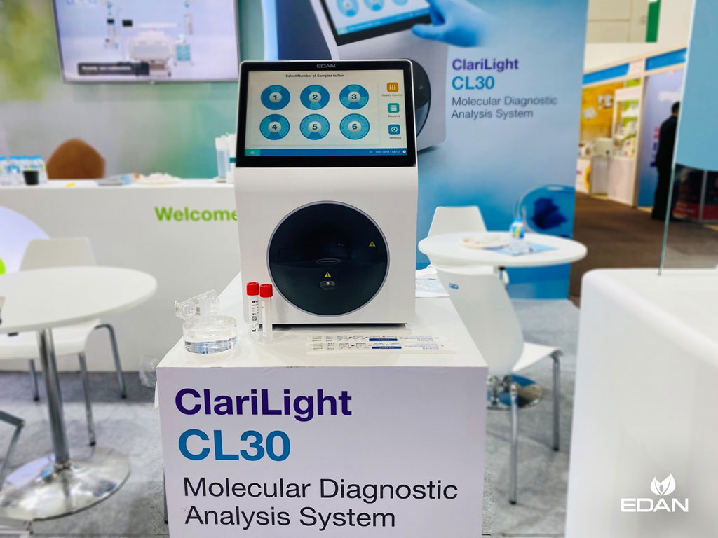 Image: ClariLight CL30 Molecular Diagnostics Analysis System (Photo courtesy of EDAN)