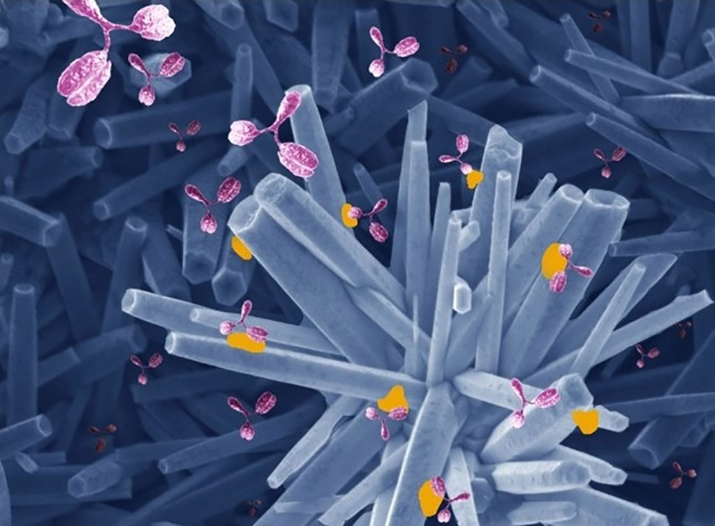 Image: Structure of zinc oxide modified with spike protein and its interaction with antibodies in sample (Photo courtesy of Karin Regina Leite de Oliveira/DK design)