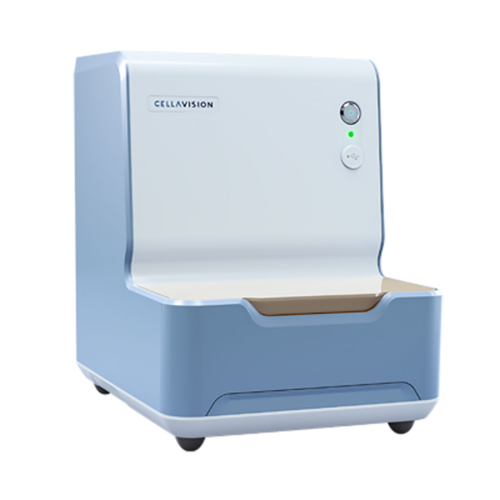 Image: The CellaVision DC-1 is a stand-alone hematology analyzer that performs blood cell differentials. It offers a suitable solution for laboratories with small workloads (Photo courtesy of Sysmex)