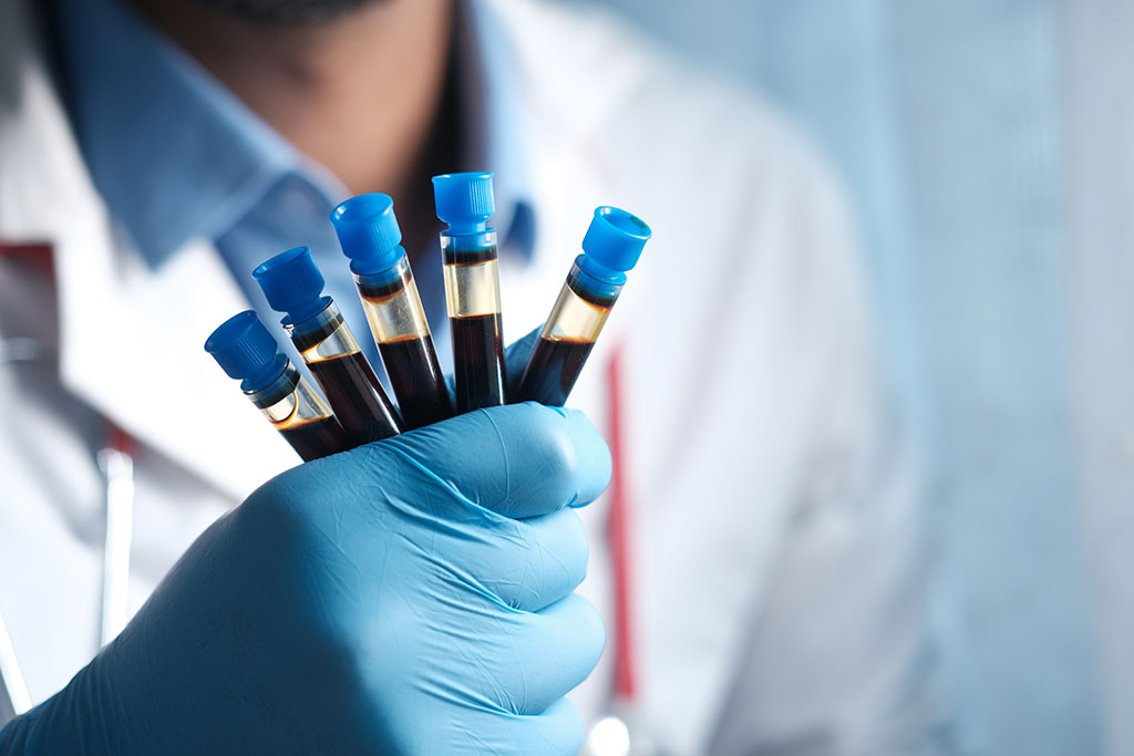 Image: Liquid biopsy approach delivers unparalleled sensitivity and specificity for detection of low-frequency mutant molecules (Photo courtesy of Pexels)