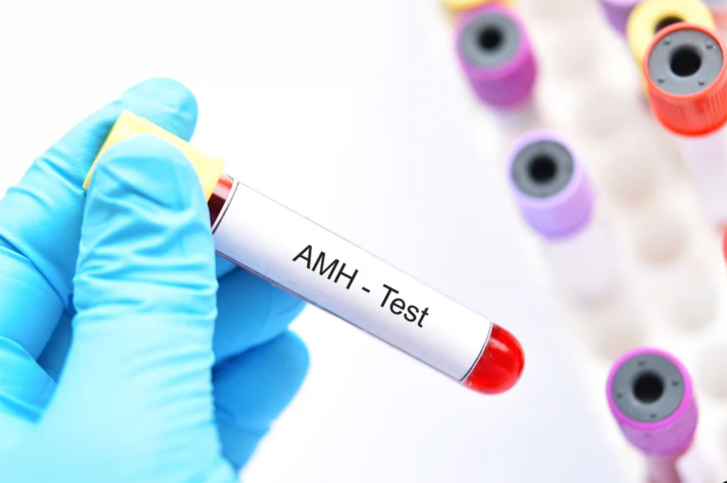 Image: Blood Test for anti-Müllerian hormone (AMH) that relates differently to lipids/lipoproteins profile in women during midlife (Photo courtesy RMA of New York)
