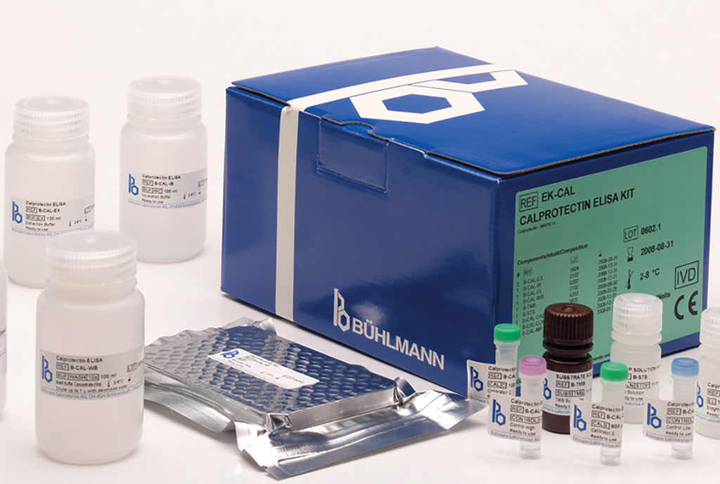 Image: The BÜHLMANN fCAL ELISA is a microtiter based assay kit for determination of calprotectin in fecal samples (Photo courtesy of Bühlmann Laboratories)