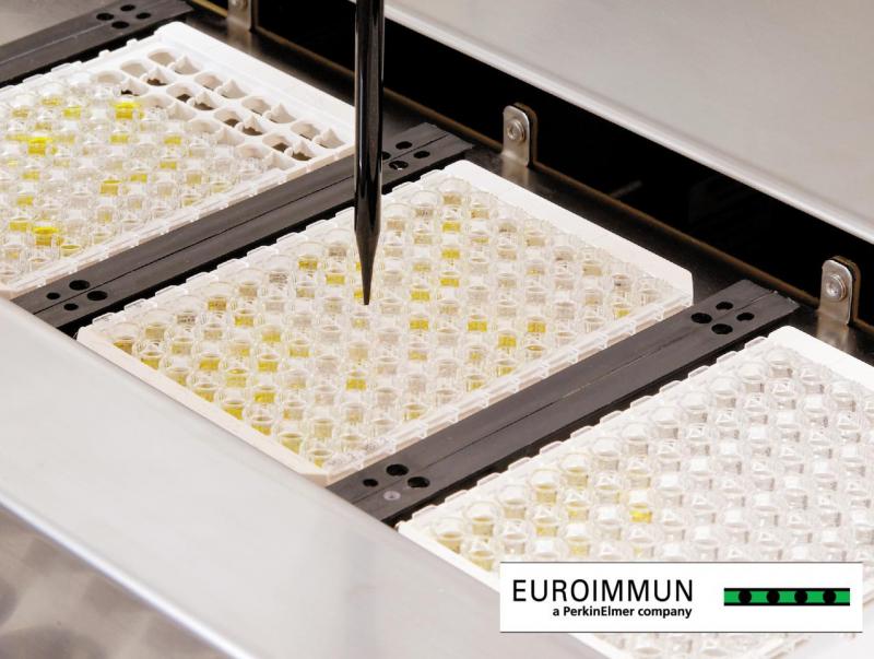 The EUROIMMUN Anti-CCHFV IgM and IgG ELISAs are based on recombinant viral nucleoprotein (Photo courtesy of EUROIMMUN)