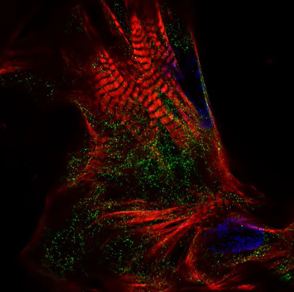 Image: The new blood test measures stress hormone levels after heart attacks (Photo courtesy of University of Oxford)