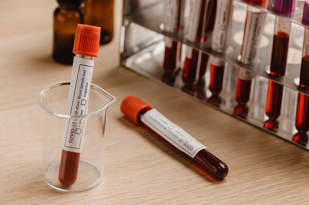 Image: The new blood test will help optimize treatment for prostate cancer patients (Photo courtesy of Pexels)