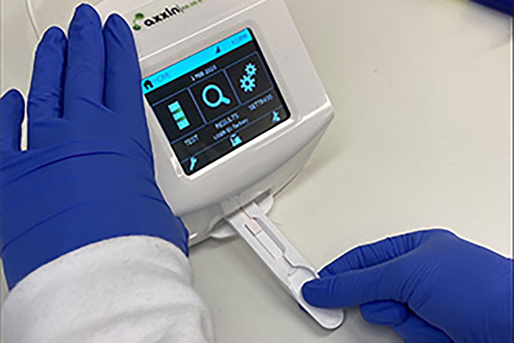 Image: The first point-of-care rapid diagnostic test can detect people at risk of malaria reinfection (Photo courtesy of WEHI)