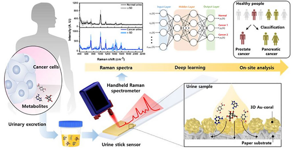 Image: Researchers have developed a new on-site rapid cancer early diagnosis sensor technology (Photo courtesy of KIMS)