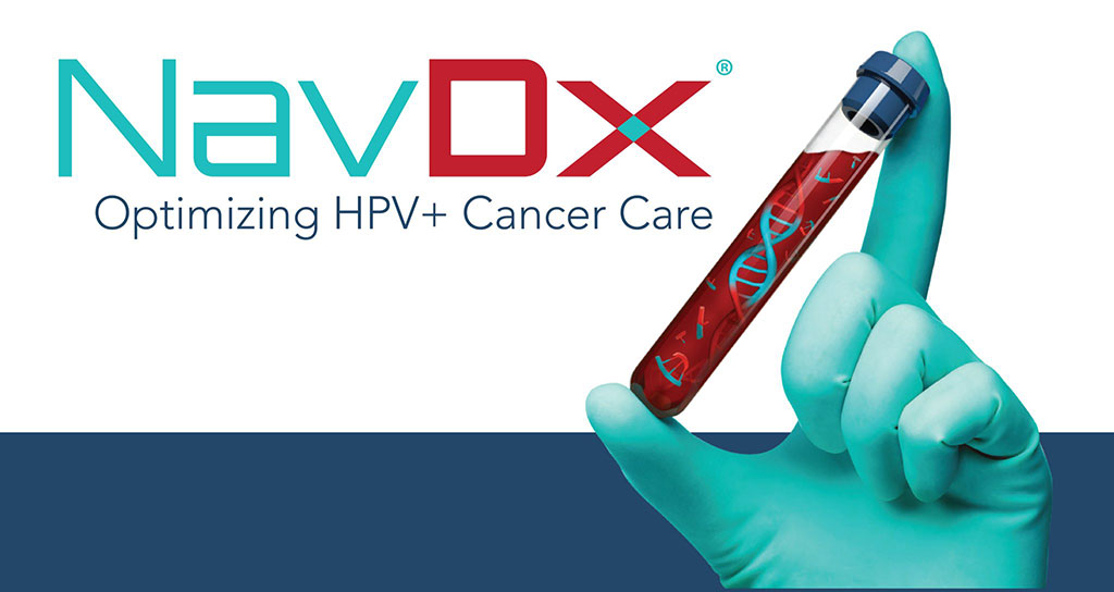 Image: The NavDx blood test uncovers the presence of HPV+ head and neck cancer across the care continuum (Photo courtesy of Naveris)