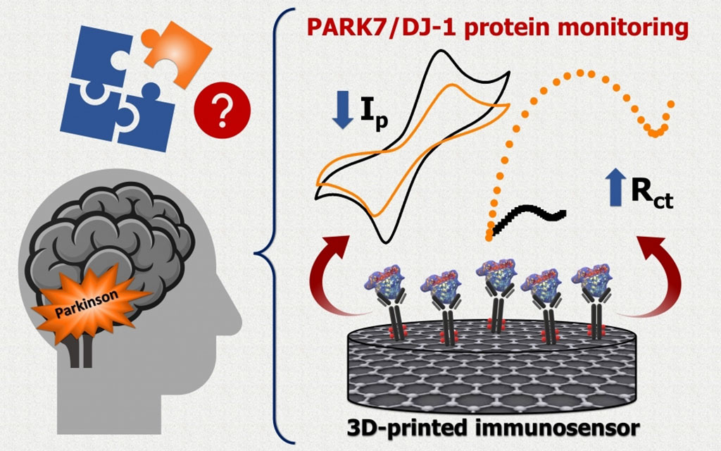 Image: The device detects levels of protein PARK7/DJ-1 which is associated with Parkinson’s (Photo courtesy of UNICAMP)